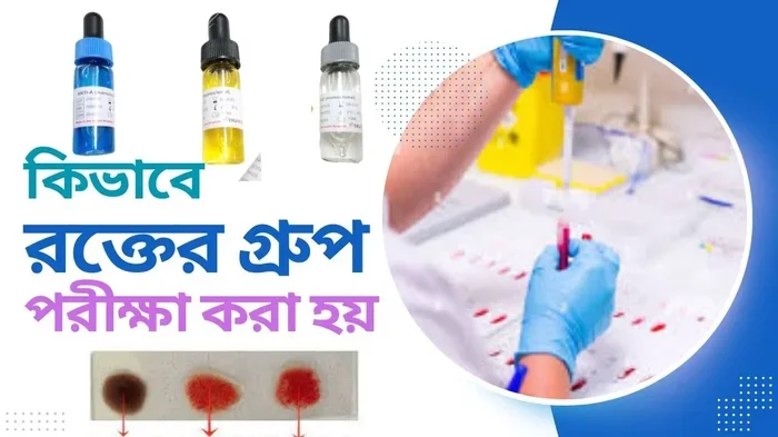 রকতর গরপ কয পরকর ও ক ক সঠক জঞন ও গরতবপরণ তথয